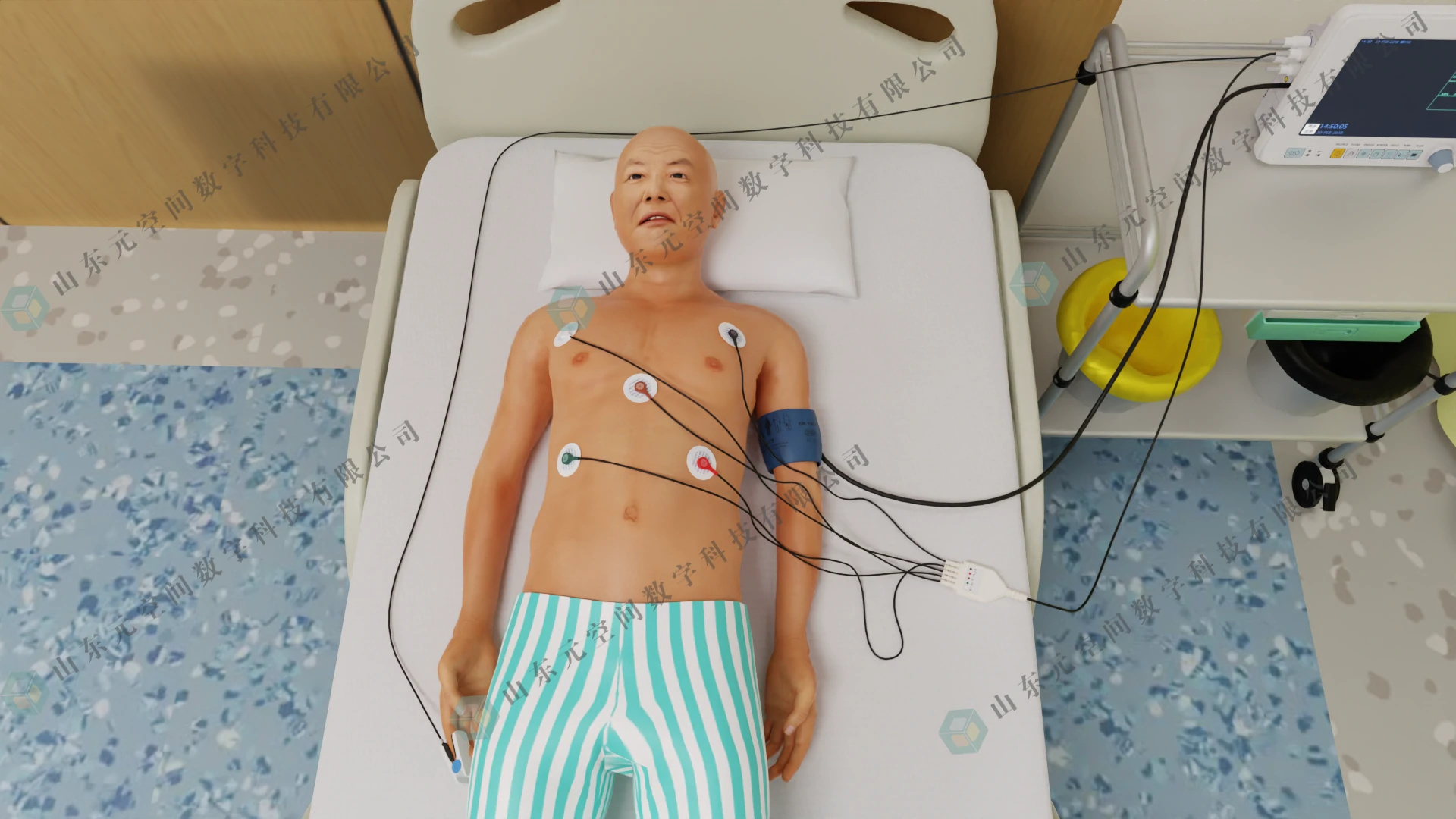 急性心肌梗死_3